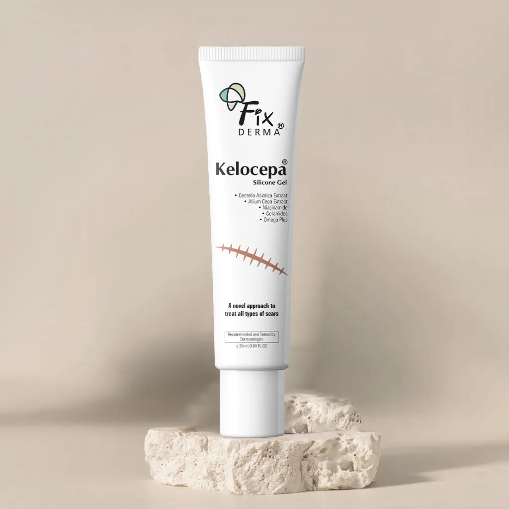 Kelocepa silicone scar gel