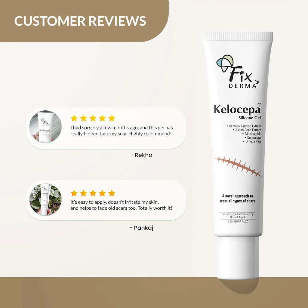 Kelocepa silicone scar gel