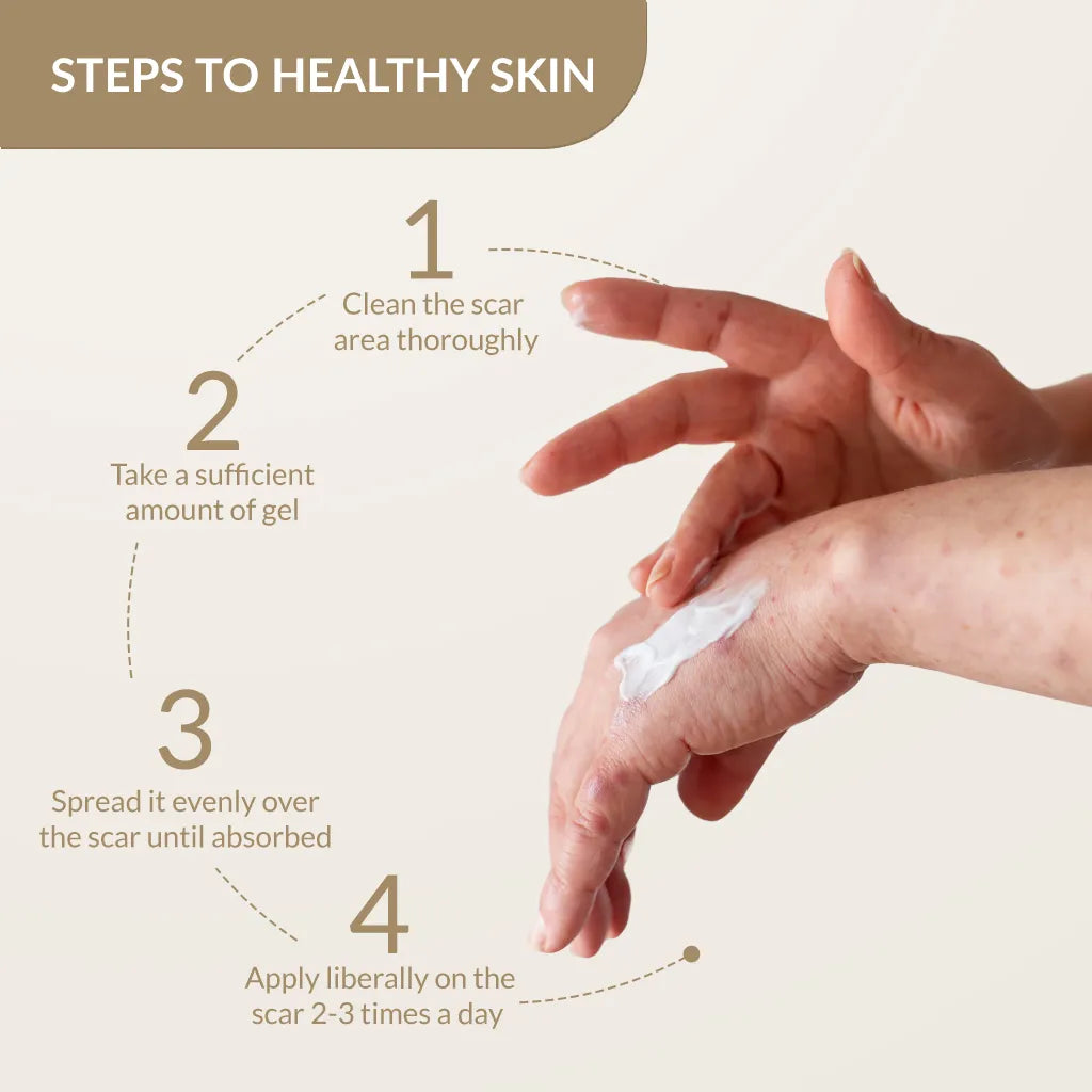Kelocepa silicone scar gel